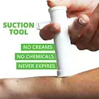 Insect Bite Poison Extractor Bed Bugs Bee Wasp Sting Sucker Natural Detoxifier