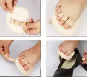 Toe Splint Corrector Straightener Triple Toe Hammer Claw Overlapping Right Foot