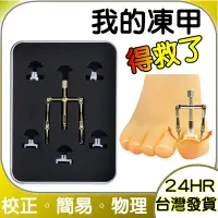 在飛比找蝦皮購物優惠-嵌甲凍甲矯正器 甲溝炎 卷甲 凍甲矯正器 凍甲 嵌甲 矯正器