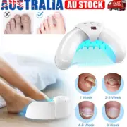 905nm Infrared Light + 470nm Blue Light Nail Fungus Laser Device Home Treatment