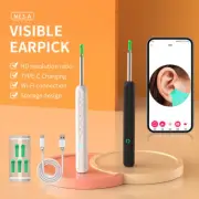 Wireless HD Ear Wax Remover Camera Ear Endoscope Spoon Pick Ear Cleaning Tool DX