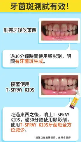 【Toothfilm 齒妍堂】T-SPRAY Kids 兒童含鈣健齒噴霧 20ml