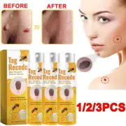 1-3× Wart Removal Mole Remover Bee Venom Treatment Spray For AII Skin Tag Recede