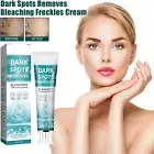Dark Spot Remover for Face Age / Liver Spots Corrector Freckles & Skin Whitening