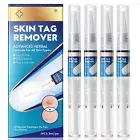 Mole Wart Remover Kit Body Face Treatment Safe Skin Tag Remover Pen Gentle
