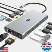 Triple Display Docking Station for Laptop, 12 in 1 USB C Hub with 2 HDMI, DP,