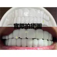 在飛比找蝦皮購物優惠-tru smile 第五代仿真牙套 自製假牙 假牙套 牙洞修