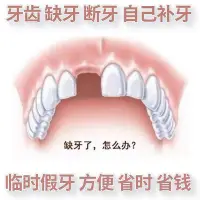 在飛比找Yahoo!奇摩拍賣優惠-【台灣】臨時假牙樹脂牙齒缺牙自己補牙齒門牙補牙縫牙洞牙套義齒
