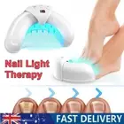 For Home Use Treatment Light Therapy Onychomycosis Nail Fungus Laser-Device Toes