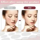 108 Pcs Acne Pimple Plasters Patch Removal Blemish Control Skin Facial Care 2025