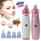 Remover Face Facial Pore Blackhead Vacuum Derma Suction Diamond Dermabrasion UL