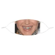 Woman Grill Grillz Teeth Gold Diamonds Halloween Fabric Face Mask