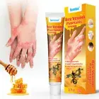 20G Bee Venom Psoriasis Cream For Relieve Dermatitis Psoriasis Itchy Skin