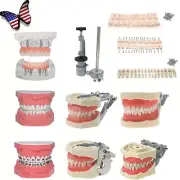 Dental Teeth Model Kit w/ Replaceable Teeth, Implant, Brackets, Mounting Pole
