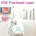 CO2 Fractional Laser Machine Skin Resurfacing Stretch Mark Treatment Scar Remove