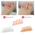 Corrector Hard Silicone Toe Finger Separator Bunion Overlapping Hammer Foot ~