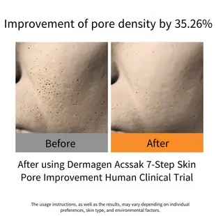 [DERMAGEN] Acssak Acne CLEAR FACIAL FOAM 180ML 祛痘潔面乳功能性祛痘洗面奶