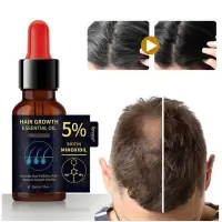 在飛比找Yahoo!奇摩拍賣優惠-熱銷# 買2送1 生薑王頭髮液養育頭髮根防止脫落5%Mino