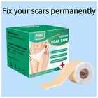 Scar Removal Silicone Tape for Acne, Pimples, Burn, Hypertrophic Scars & Keloids