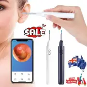 Ear Wax Remover Pick LED Light Scoop Tool Camera Cleaning Ear Cleaner Removal QT