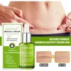 Scar Repair Serum for All Scars and Stretch Marks Advanced Formula！