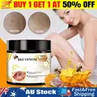 Bee Venom Skin Tag Removal Treatment Cream For Body Care Mole Corn Skin Wart NEW