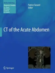 CT of the Acute Abdomen, Hardcover by Taourel, Patrice (EDT); Baert, Albert L...