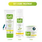 SAFI SET Naturals Acne Treatment Aloe Tea Tree Oil Antioxidant Moisture Nourish
