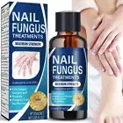 Onychomycosis Care Liquid Nail Guard Onychomycosis Liquid Toenail Net Liquid