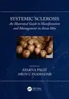 Systemic Sclerosis: An Illustrated Guide to Manifestation and Management in Asia