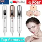 Laser Freckle Removal Machine Skin Mole Dark Spot Face Wart Tag Remover Pen AU