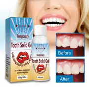 Temporary Tooth Repair Kit Teeth Gaps False Teeth Solid Glue Denture Adh.pi