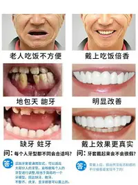 在飛比找樂天市場購物網優惠-日本進口仿真假牙套牙老人沒牙專用吃飯神器可咀嚼臨時牙套美白牙