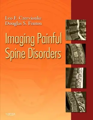 Imaging Painful Spine Disorders