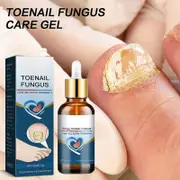 Fungal Nail Treatment, Fungal Nail Treatment For Toenails Extra Strong Anti Fungus,strongest Antifungal Nail Polish For Damaged Nail Repair 1 pcs