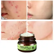 Portable Herbal Acne Treatment Cream Multipurpose Moisturizing Cream Professional Facial Care 30g