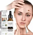 Mole & Wart Skin Face Armpit Flesh Removal Care Remove Tags Collagen Peptides