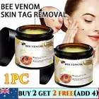 Bee Venom Skin Tag Removal Treatment Cream For Body Care Mole Corn Skin Wart _AU