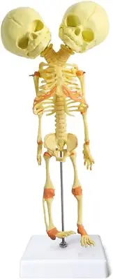 Human Infant Skeleton Model, Twin-Skull, Human Fetus Skeleton W/Double-Skull Mod
