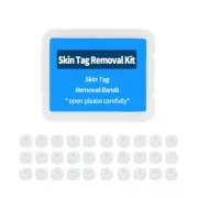 30pcs Rubber Rings Skin Tag Removal Bands Mole Wart Micro Bands Tag Remover Tool