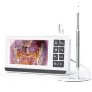 3.9mm4.3 Inch Digital Otoscope for Ear Wax Cleaning Smart Visual Ear Picking Stick Type-C Port Supports Connection to Co