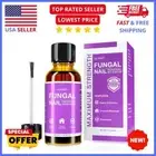 Nail Fungus Treatment Extra Strength (1 oz): For Fast Repair of Toe & Fingernail