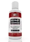 Bump Terminator Lotion for Facial Shaved Head & Ingrown Hair Bumps (4oz)