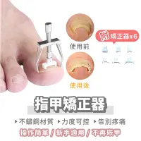 在飛比找蝦皮購物優惠-【指甲矯正器】七件組 嵌甲 凍甲 卷甲 矯正器 甲溝炎 指甲