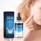 Wart Remover Serum Fast Safe Natural Treatment Skin 30ml Tags GXO P0R3