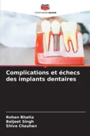 Complications et échecs des implants dentaires [French] by Rohan Bhatia