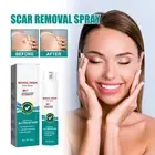 Scar Removal Spray for Acne Scars Surgical Scars and Stretch Marks Scar Spray