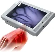 Vein Finder Viewer, Vessel Imaging Instrument,Blood Vessel Vein Locator Finder Devices,Vein Finder for Nurses, Easy Finding Subcutaneous Veins Device for Nurse Elderly Children
