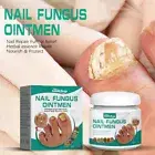 Repair Paronychia Care Ointment Anti fungal Nail Fungus Treatment Serum Cream
