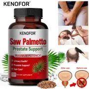 Saw Palmetto Prostate Support – Immune System and Hair Health
